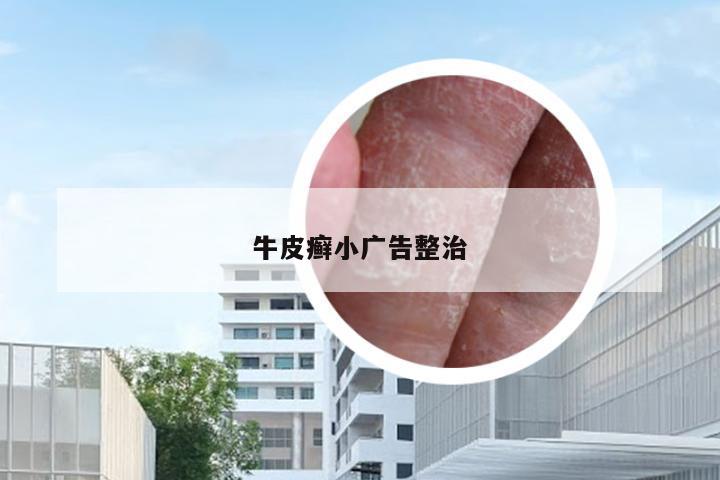 牛皮癣小广告整治