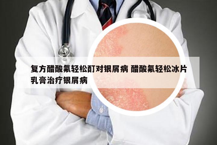 复方醋酸氟轻松酊对银屑病 醋酸氟轻松冰片乳膏治疗银屑病