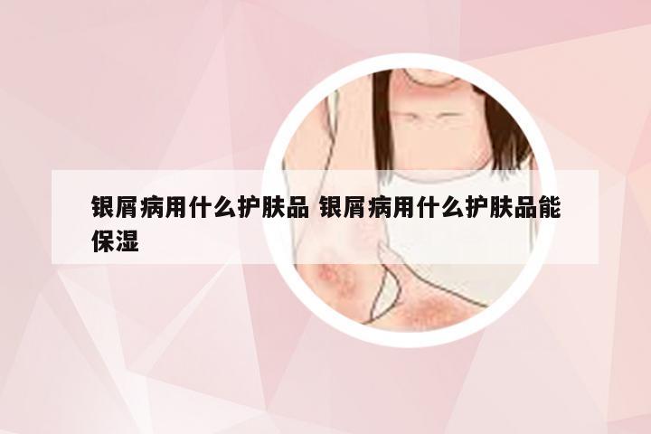 银屑病用什么护肤品 银屑病用什么护肤品能保湿