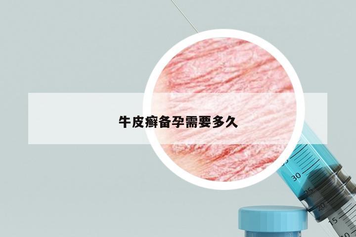 牛皮癣备孕需要多久