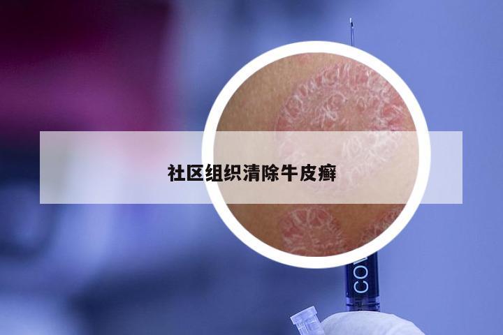 社区组织清除牛皮癣