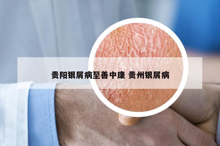 贵阳银屑病至善中康 贵州银屑病