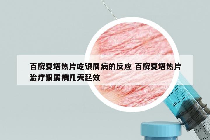 百癣夏塔热片吃银屑病的反应 百癣夏塔热片治疗银屑病几天起效
