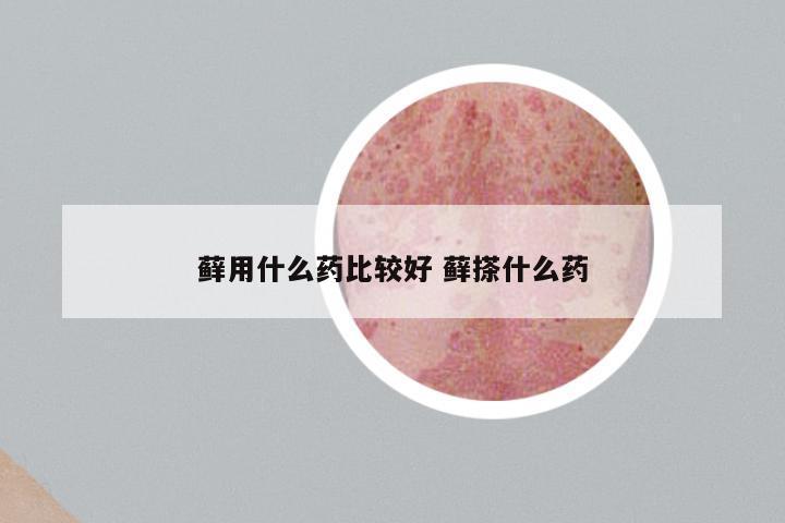 藓用什么药比较好 藓搽什么药