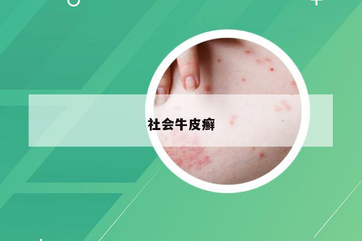 社会牛皮癣