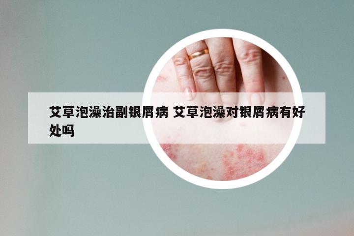 艾草泡澡治副银屑病 艾草泡澡对银屑病有好处吗