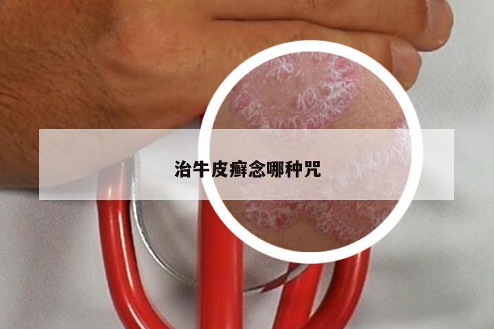 治牛皮癣念哪种咒