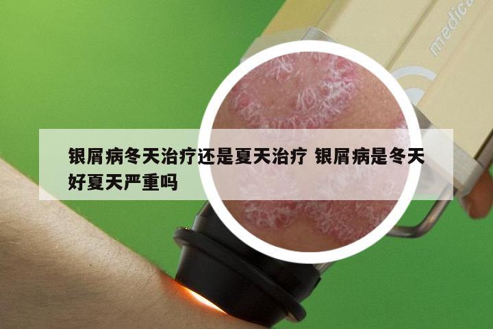 银屑病冬天治疗还是夏天治疗 银屑病是冬天好夏天严重吗