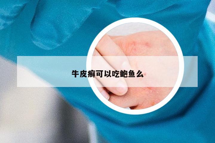 牛皮癣可以吃鲍鱼么