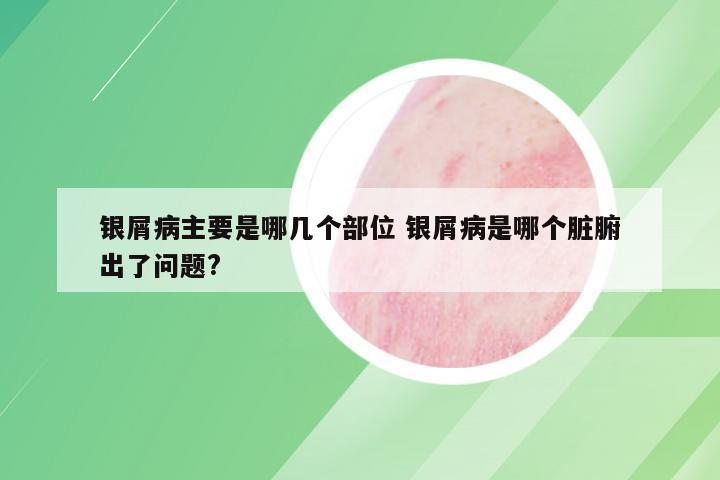 银屑病主要是哪几个部位 银屑病是哪个脏腑出了问题?
