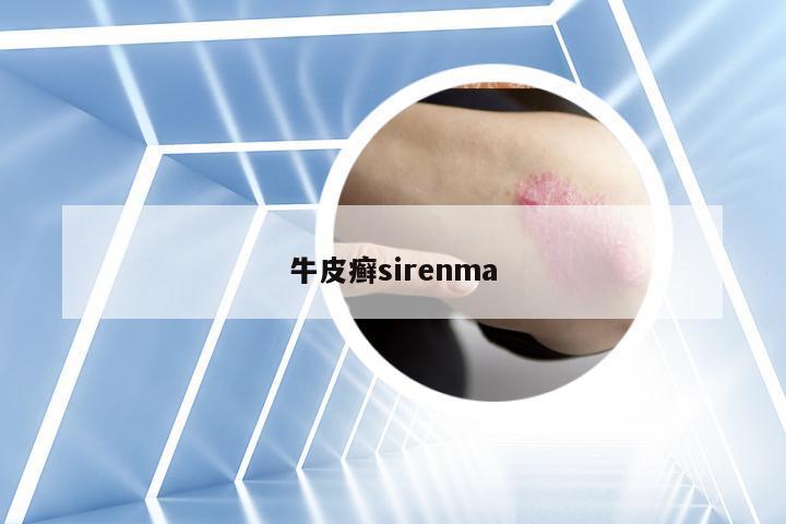 牛皮癣sirenma