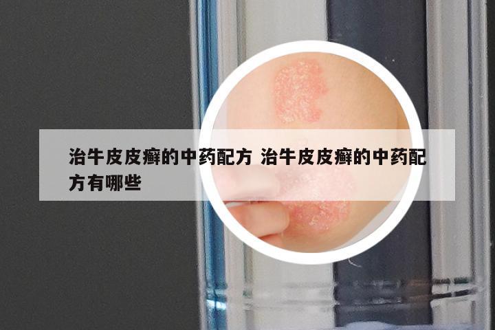 治牛皮皮癣的中药配方 治牛皮皮癣的中药配方有哪些