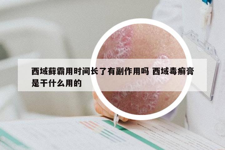 西域藓霸用时间长了有副作用吗 西域毒癣膏是干什么用的