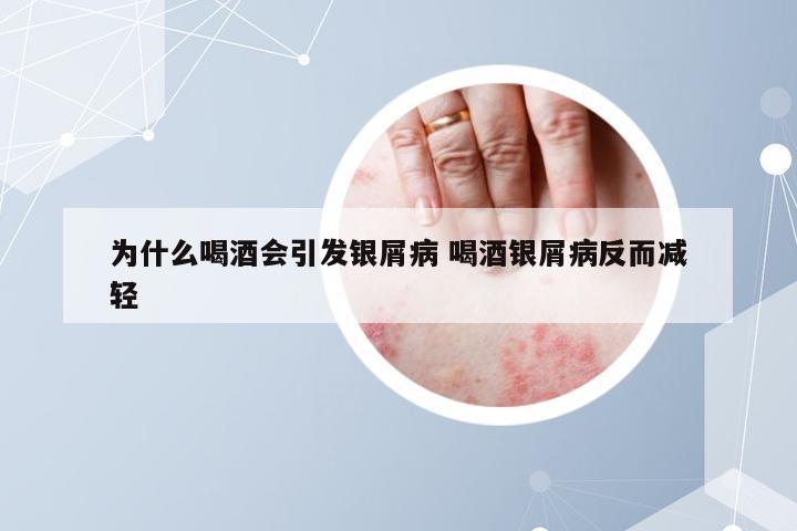 为什么喝酒会引发银屑病 喝酒银屑病反而减轻