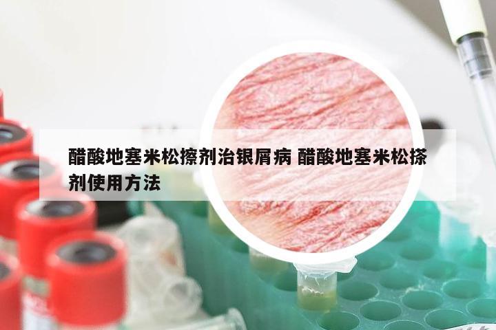 醋酸地塞米松擦剂治银屑病 醋酸地塞米松搽剂使用方法