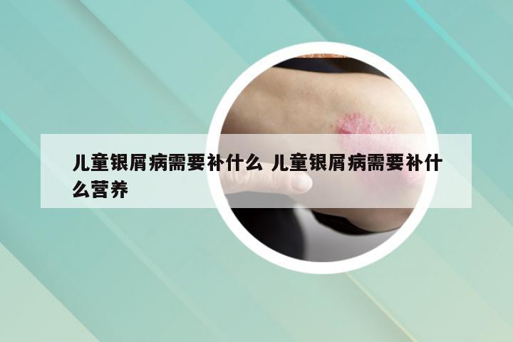 儿童银屑病需要补什么 儿童银屑病需要补什么营养