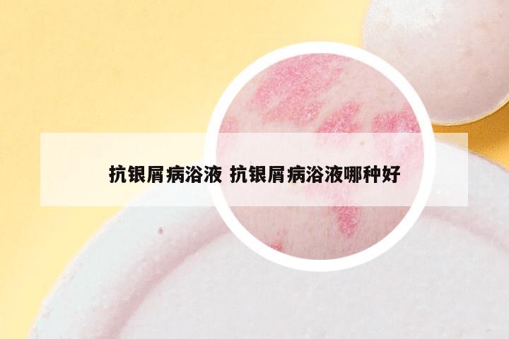 抗银屑病浴液 抗银屑病浴液哪种好
