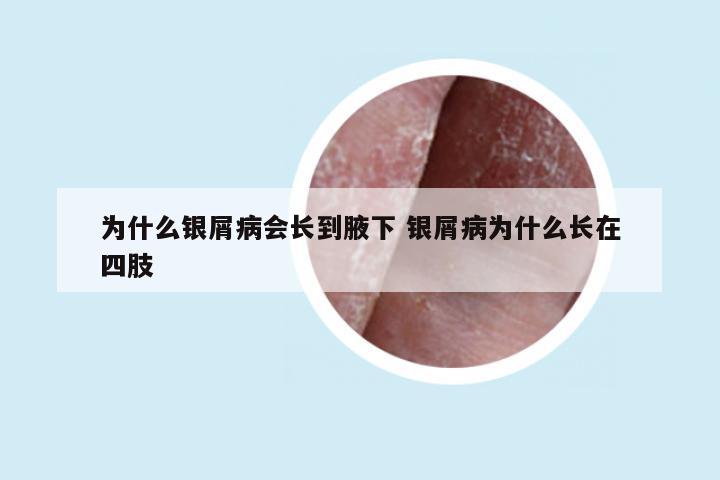为什么银屑病会长到腋下 银屑病为什么长在四肢