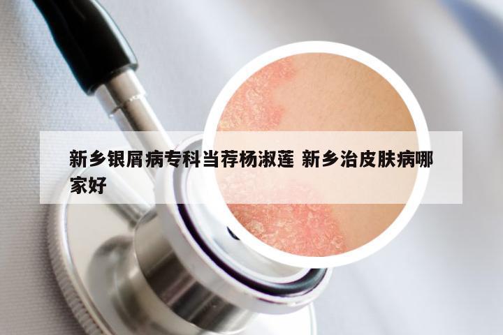 新乡银屑病专科当荐杨淑莲 新乡治皮肤病哪家好