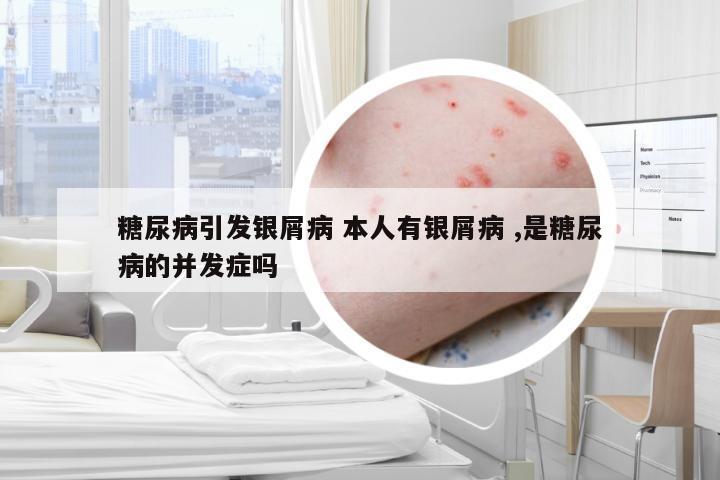 糖尿病引发银屑病 本人有银屑病 ,是糖尿病的并发症吗