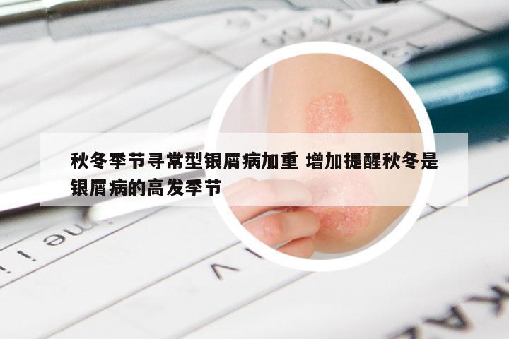 秋冬季节寻常型银屑病加重 增加提醒秋冬是银屑病的高发季节