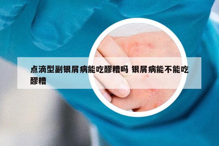点滴型副银屑病能吃醪糟吗 银屑病能不能吃醪糟