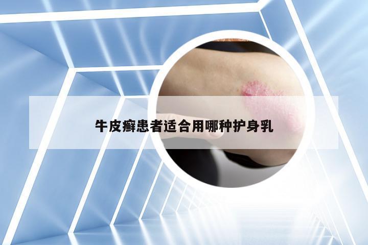 牛皮癣患者适合用哪种护身乳