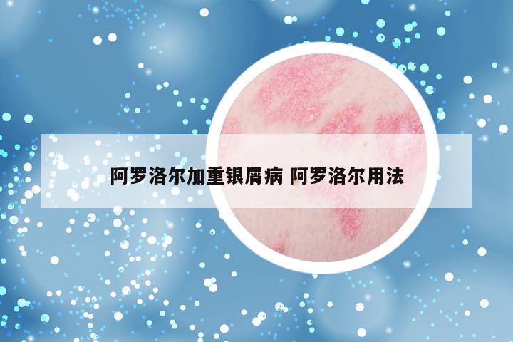 阿罗洛尔加重银屑病 阿罗洛尔用法