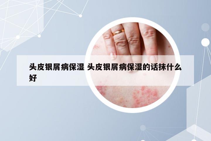 头皮银屑病保湿 头皮银屑病保湿的话抹什么好