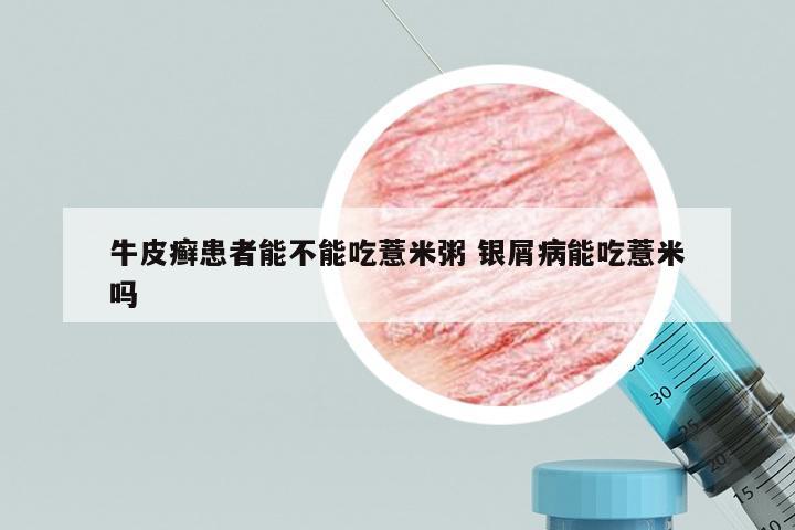 牛皮癣患者能不能吃薏米粥 银屑病能吃薏米吗