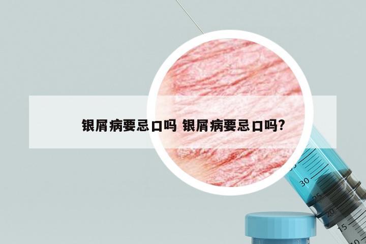 银屑病要忌口吗 银屑病要忌口吗?
