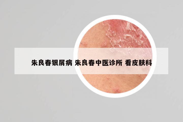 朱良春银屑病 朱良春中医诊所 看皮肤科