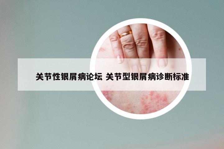 关节性银屑病论坛 关节型银屑病诊断标准