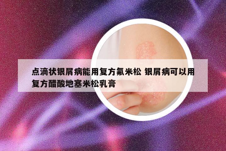 点滴状银屑病能用复方氟米松 银屑病可以用复方醋酸地塞米松乳膏