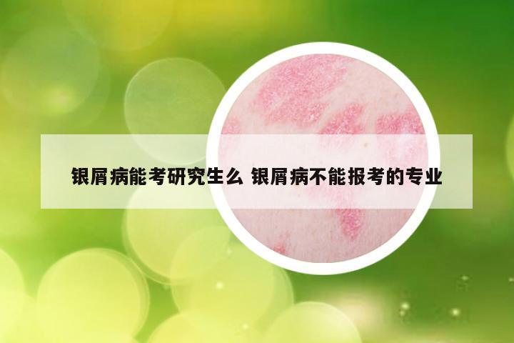 银屑病能考研究生么 银屑病不能报考的专业