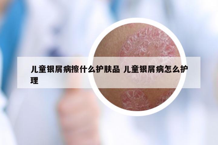 儿童银屑病擦什么护肤品 儿童银屑病怎么护理