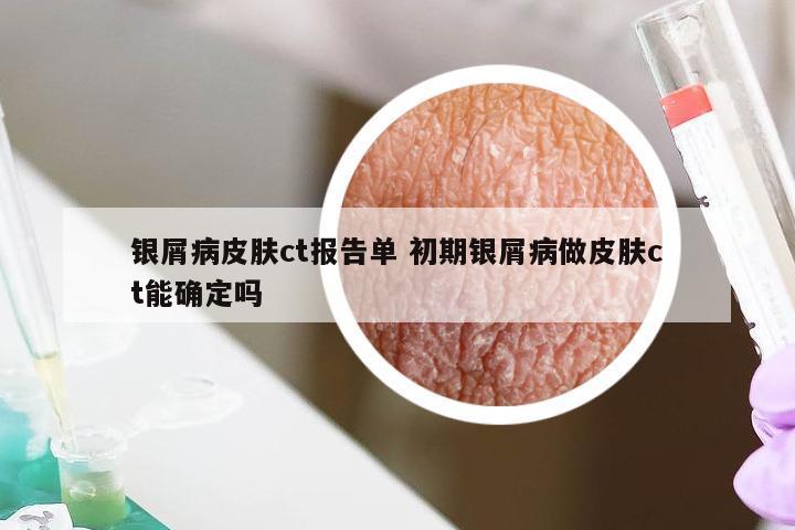 银屑病皮肤ct报告单 初期银屑病做皮肤ct能确定吗