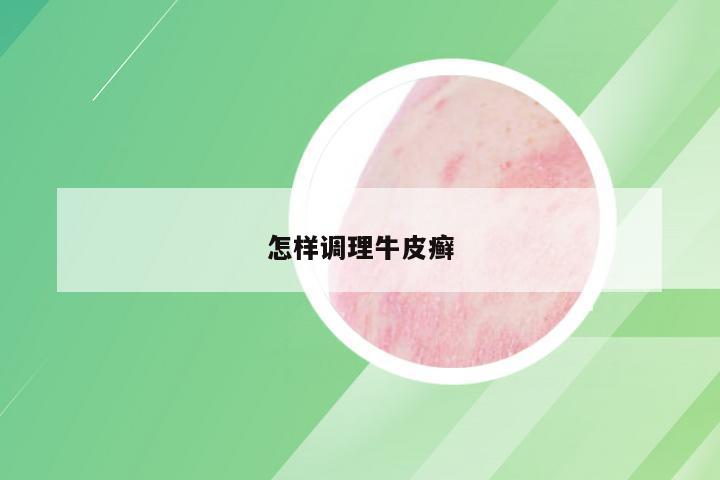 怎样调理牛皮癣