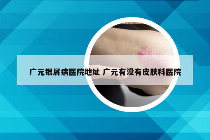 广元银屑病医院地址 广元有没有皮肤科医院