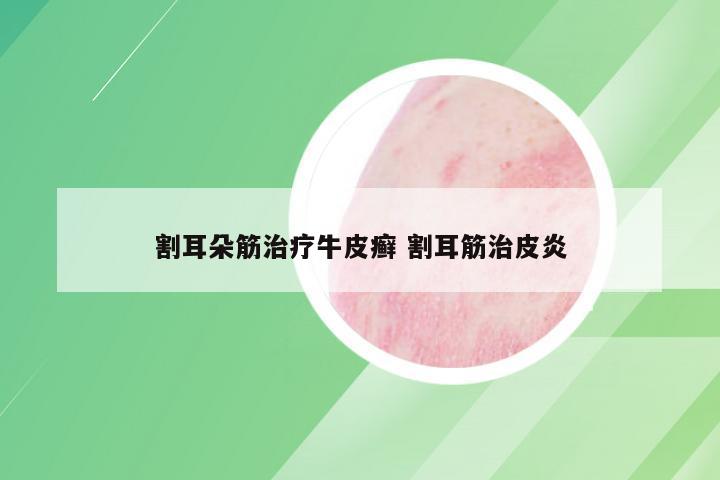 割耳朵筋治疗牛皮癣 割耳筋治皮炎