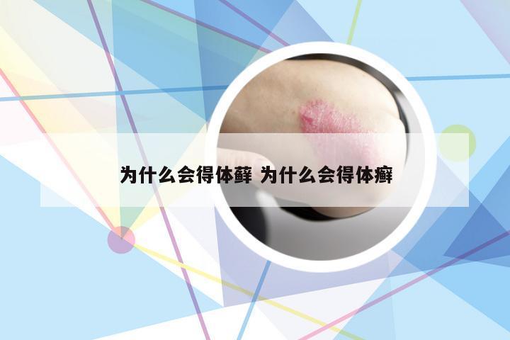 为什么会得体藓 为什么会得体癣