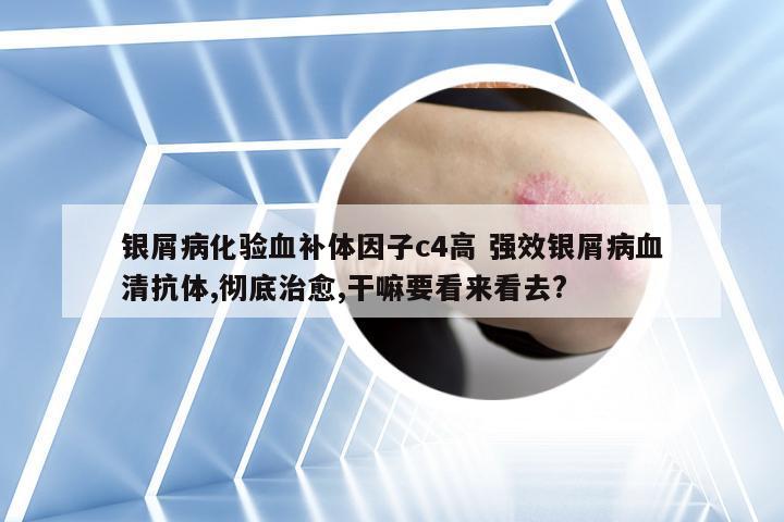 银屑病化验血补体因子c4高 强效银屑病血清抗体,彻底治愈,干嘛要看来看去?