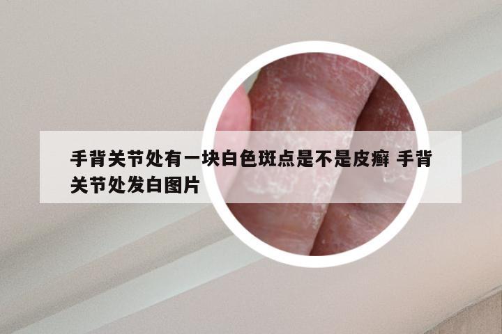 手背关节处有一块白色斑点是不是皮癣 手背关节处发白图片