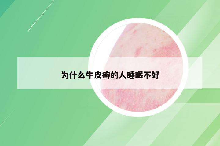 为什么牛皮癣的人睡眠不好