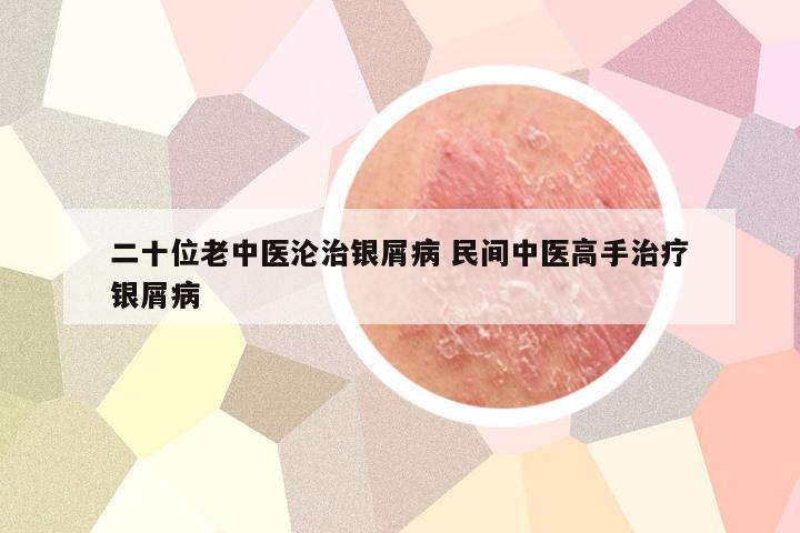二十位老中医沦治银屑病 民间中医高手治疗银屑病