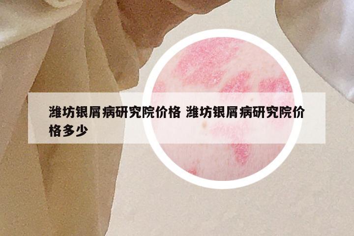 潍坊银屑病研究院价格 潍坊银屑病研究院价格多少