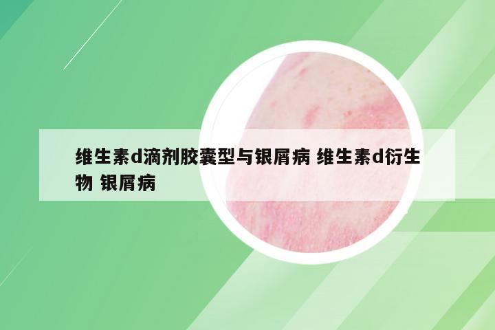 维生素d滴剂胶囊型与银屑病 维生素d衍生物 银屑病