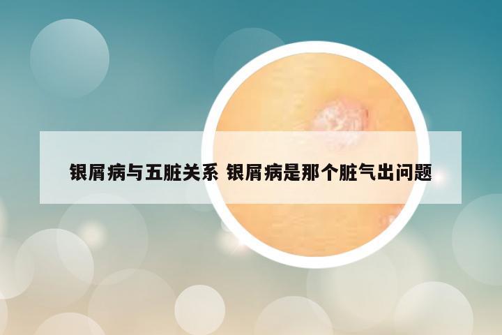 银屑病与五脏关系 银屑病是那个脏气出问题