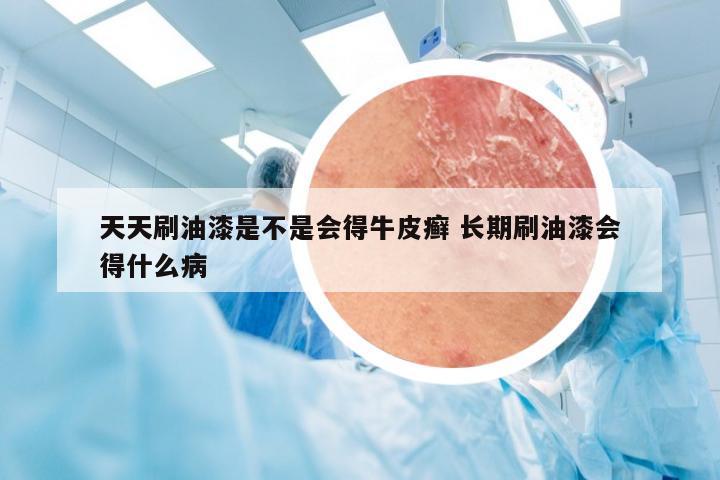天天刷油漆是不是会得牛皮癣 长期刷油漆会得什么病