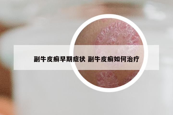 副牛皮癣早期症状 副牛皮癣如何治疗